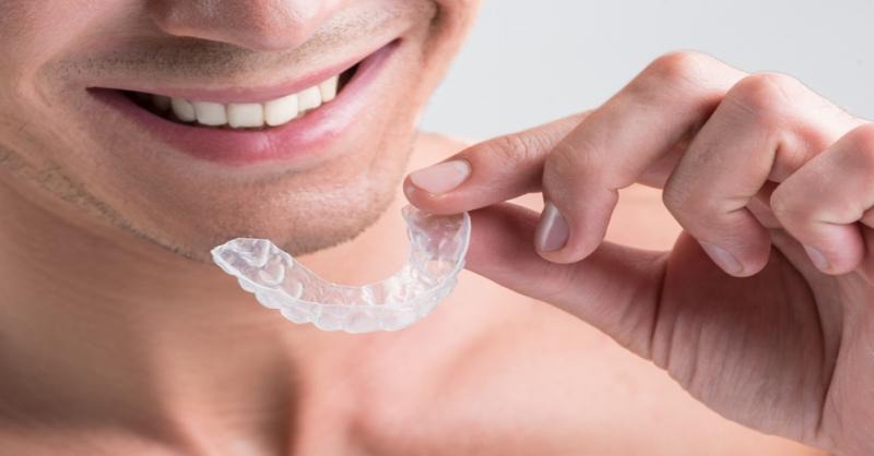 Invisalign VS Aparelhos